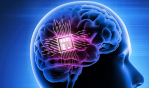 implantes cerebrais em humanos.
